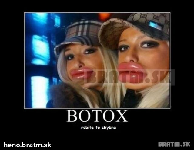 CHybný pokus o Botox :D