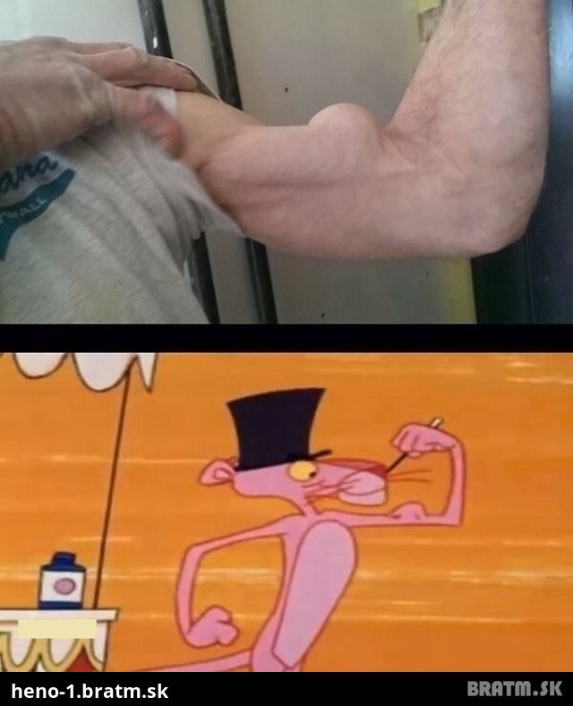 LOL! Našli sme muža, ktorý ma rovnaký biceps ako ružový panter :D