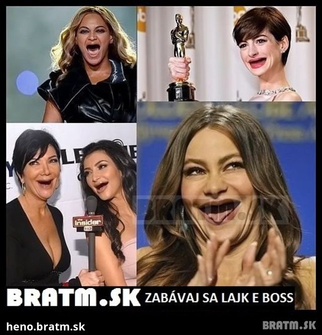 Ako by vyzerali celebrity bez zubov :D
