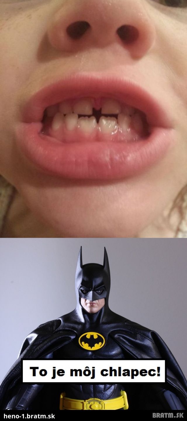 Ako vyzerá Batmanov obľúbený chlapec :D