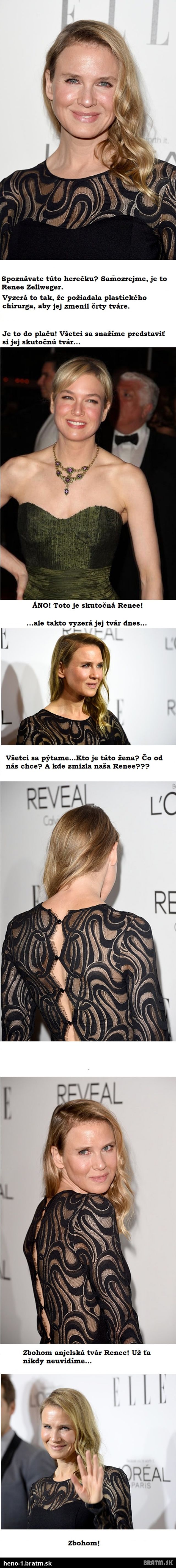 Neskutočné! Tvár známej herečky Renee Zellweger sa zmenila na nepoznanie!