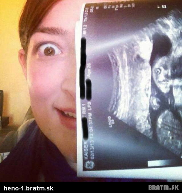 Kokso! Tak to čo ma táto žena na ultrazvuku je naozaj funny :)