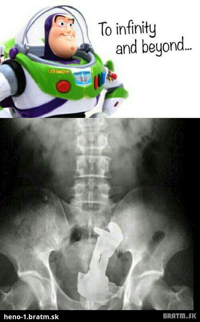 Huste! To co je vidiet na tejto rentgenovej snimke je zvlastne!