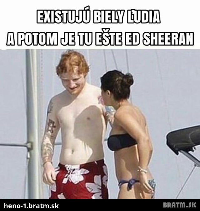 ED SHEERAN, to je celebrita, ktorú zbadáte už na míle :D