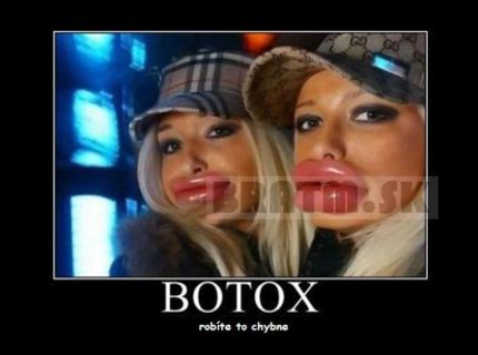 CHybný pokus o Botox :D