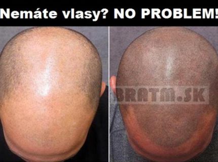 Tetovanie vlasov ... celkom dobrý nápad :D