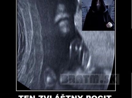 Zvláštny pocit, keď vaše dieťa vyzerá ako Emperor Palpatine  :D