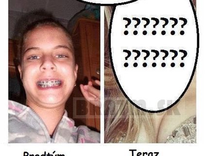 Rozdiel v puberte :D