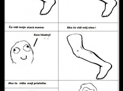 Ako ľudia vnímajú, keď mám modrinu :D