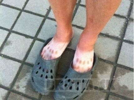Toto je dôvod, prečo nenosím takúto obuv :D