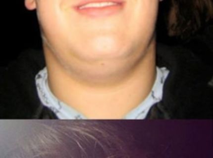 Ako sa môže zmeniť tvoja tvár, keď schudneš :)