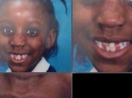 Kreativita detských zúbkov :D