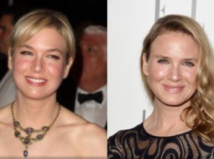 Neskutočné! Tvár známej herečky Renee Zellweger sa zmenila na nepoznanie!