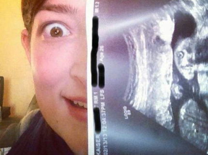 Kokso! Tak to čo ma táto žena na ultrazvuku je naozaj funny :)