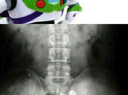 Huste! To co je vidiet na tejto rentgenovej snimke je zvlastne!
