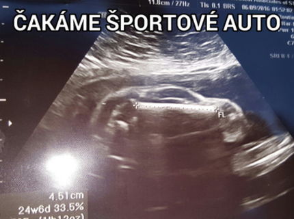 Pozri sa na tento snímok z bruška tehotnej maminky.... :)